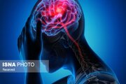علائم سکته مغزی را جدی بگیرید/زمان، عامل تعیین‌کننده است
